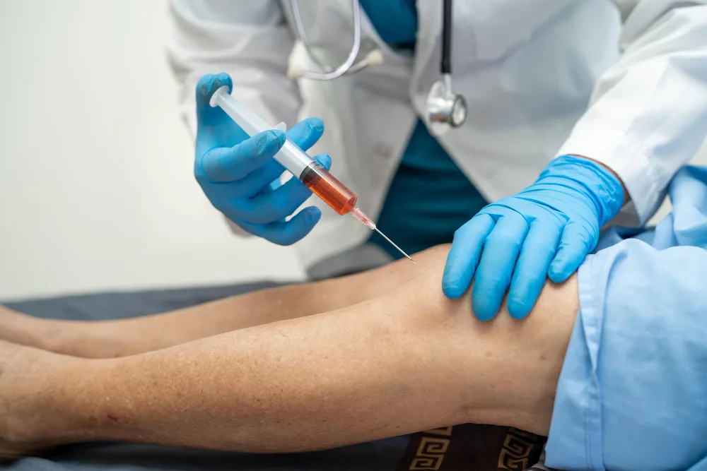 Plasma Rico en Plaquetas (PRP) en CDMX: aprovecha tus factores de crecimiento para recuperar tejidos